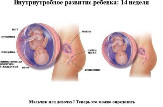 14 nedelya beremennosti chastoe mocheispuskanie