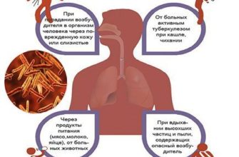 chem opasna privivka bczh