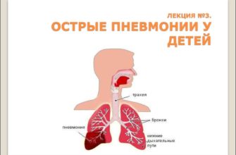 ostraya bronhopnevmoniya u detej