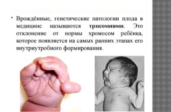 patologii ploda