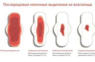 vydeleniya posle kesareva secheniya zheltogo cveta