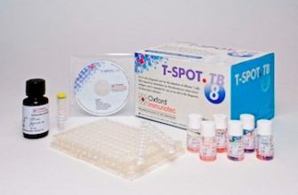 t spot na tuberkulez gde sdelat