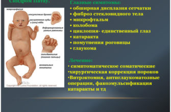 vrozhdennye patologii u detej